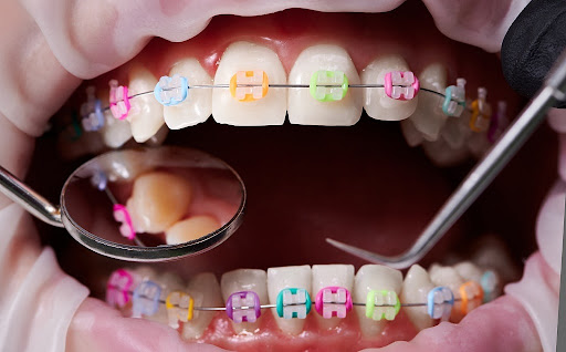 La Merced Clínica Dental Valencia Centro Ortodoncistas