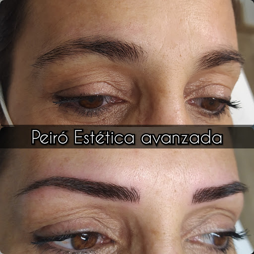 Microblading Valencia - Mesoterapia Valencia - Peiró Estética Avanzada