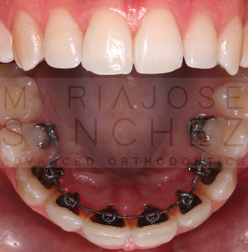 Maria Jose Sanchez ortodoncia avanzada