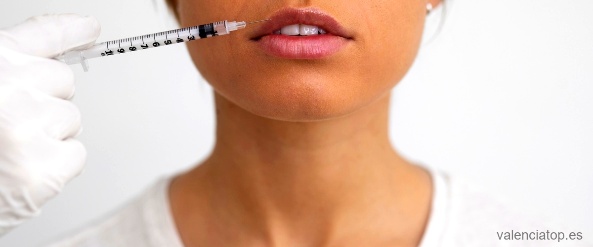 ¿Cuánto tiempo dura el tratamiento de relleno de labios con ácido hialurónico?